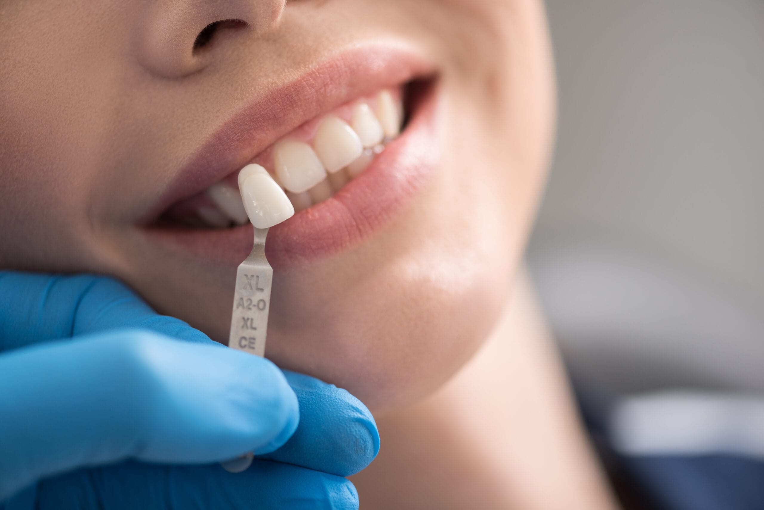 Teeth model locating near brilliant woman smile